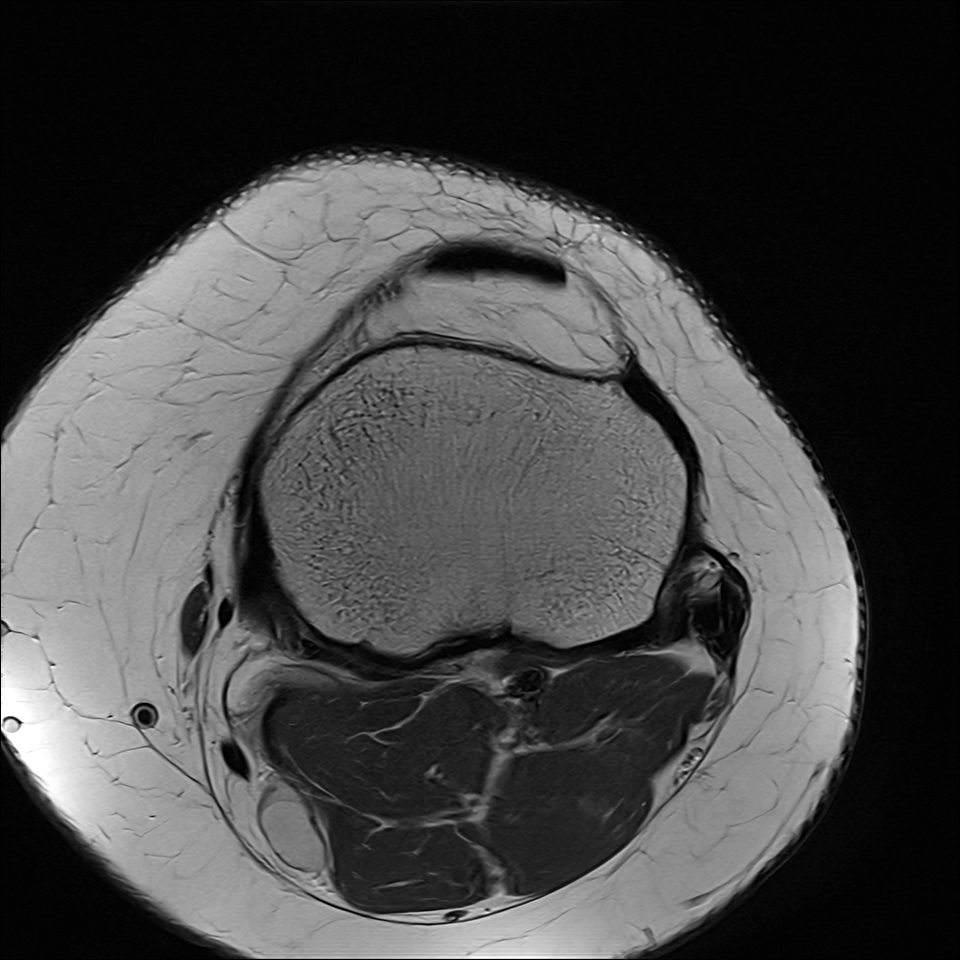 Real RSNA DICOM MRI Slice